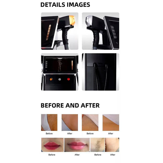 Depiladora ICE Cuatriláser Platinium