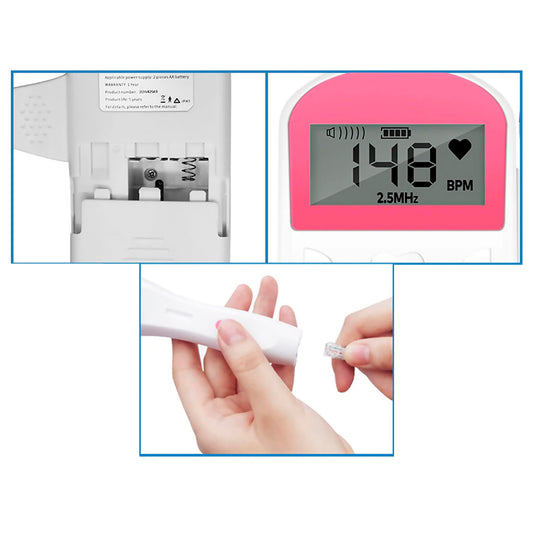 Monitor Fetal Doppler Latidos Fetales Corazón Bebé